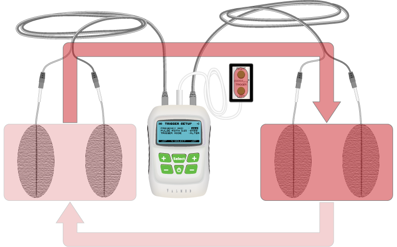 SwissSTIM Trigger alternated mode