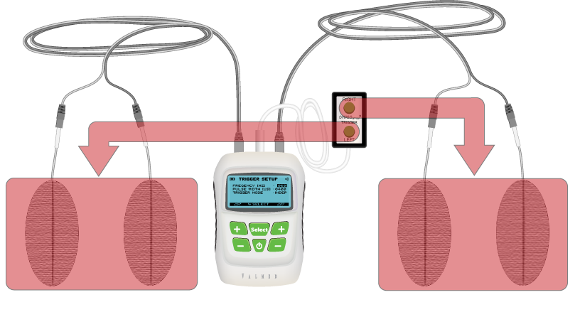 SwissSTIM Trigger independant mode