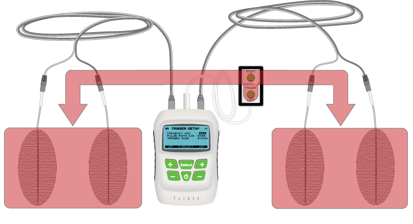 SwissSTIM Trigger synchronized mode